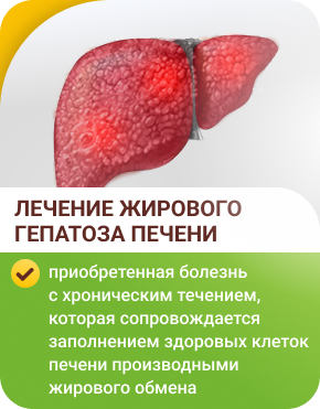 Жировой гепатоз