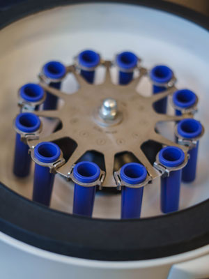 лечение цитомегаловируса