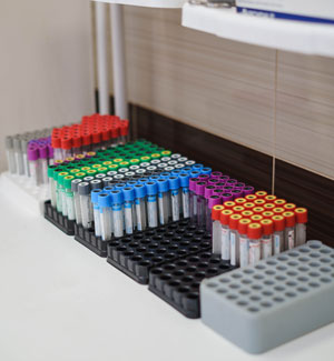 Анализ на вирус герпеса 7 типа