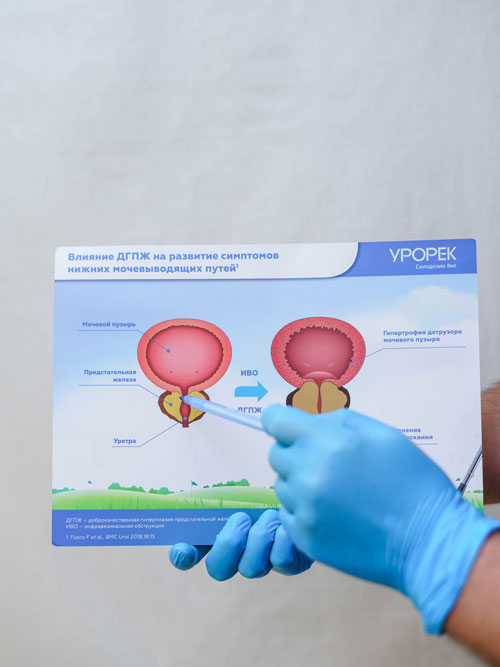 Консультация уролога 